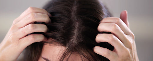 Woman scratches her itchy scalp