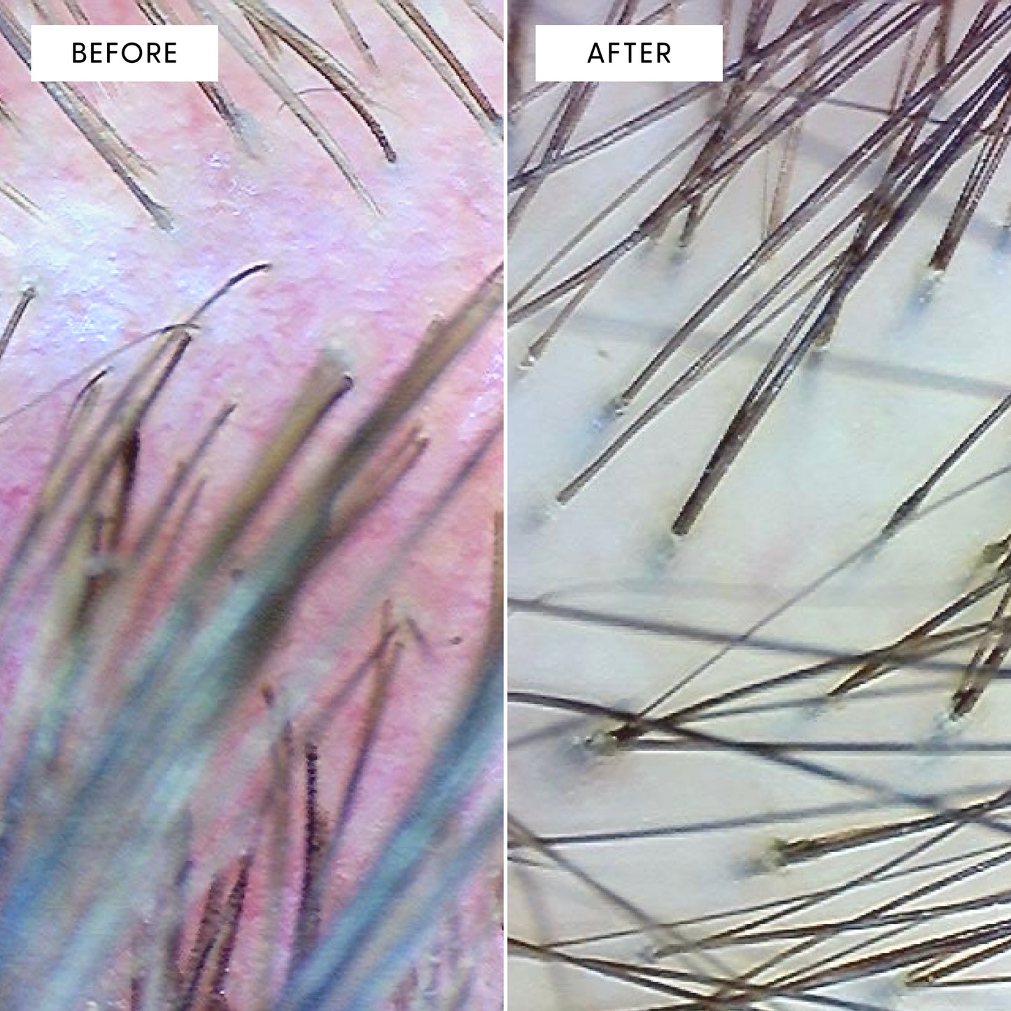 Close up image of a scalp before and after using Calm It Down. Before is red and irritated, after is healthy and clean.